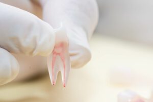 endodontist in Gurnee IL