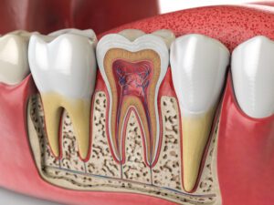 root canal Gurnee tooth pain in Libertyville